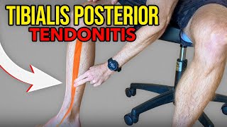 3 Exercises for Tibialis Posterior Tendonitis [upl. by Fitalludba]