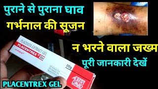 Placentrex Gel Uses Or Side Effects in Hindi [upl. by Anawal698]