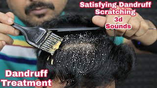 Satisfying Dandruff Scratching ASMR Dandruff Treatment by biswajit barber [upl. by Essex817]