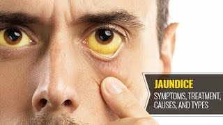 Jaundice part1 पीलिया  Mechanism and biochemistry of Jaundice [upl. by Sokairyk]