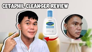 CETAPHIL GENTLE SKIN CLEANSER REVIEW  CETAPHIL FACIAL WASH REVIEW  FOR PIMPLES AND ACNE [upl. by Lehsreh]