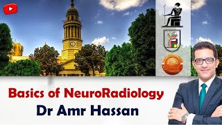 Basics of NeuroRadiologyأد عمرو حسن الحسني [upl. by Finnie]