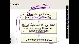 Investigation and treatment of stable angina [upl. by Derian]