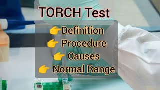 TORCH Test  Complete Procedure  Hindi  Urdu [upl. by Ahsek]