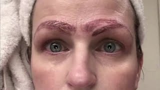 Woman Left With 4 Eyebrows After Microblading Treatment Goes Horribly Wrong [upl. by Les]