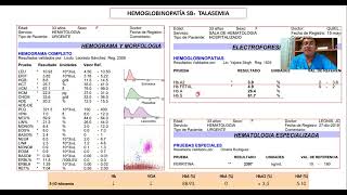 HEMOGLOBINOPATÍA SB TALASEMIA [upl. by Peria271]