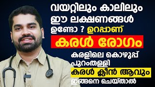 കരളിലെ കൊഴുപ്പ് പുറംതള്ളി കരൾ ക്ലീൻ ആവും ഇങ്ങനെ ചെയ്താൽ  Fatty Liver and Liver Disease Malayalam [upl. by Aihsakal]