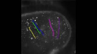 Cytoplasmic Streaming of Female Drosophila at Stage 11 Oogenesis Manual Particle Tracking SC [upl. by Berck]