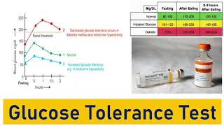 Glucose Tolerance Test OGTT IGTT Glucose Tolerance Curve Typical Values and the Impact [upl. by Lowe190]