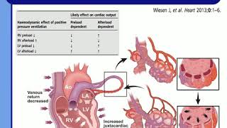 UNDERSTAND CARDIOPULMONARY INTERACT TO AVOID CLINICAL DISASTERS JD Chiche 2015 [upl. by Pucida398]