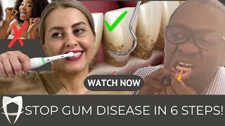 Gum Disease Treatment 2024  Periodontists Comprehensive Guide Including Causes and Treatment [upl. by Casta]