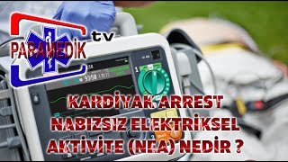 EKG  ÖLÜMCÜL RİTİMLER  NABIZSIZ ELEKTRİKSEL AKTİVİTE ye yaklaşım [upl. by Yotal]