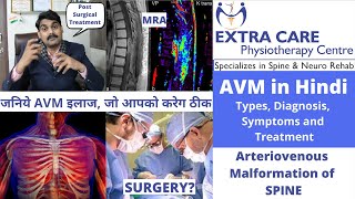 Arteriovenous Malformation of SPINE  Types Diagnosis Symptoms amp Treatment  AVM in HINDI [upl. by Eem]