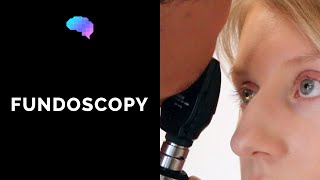 Fundoscopy Ophthalmoscopy  OSCE Guide  UKMLA  CPSA [upl. by Oek282]