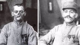 Sculptor Made Masks for Wounded WWI Soldiers with Disfigured Faces  New York Post [upl. by Amund]