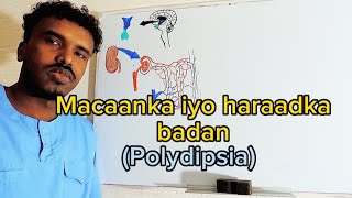 Xanuunka Macaanka iyo Haraadka badanPolydipsia in DM [upl. by Hillari]