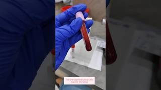 Hba1c test laboratorylife hba1c bloodsugar bloodcollection ytshorts bloodtest ytstudio rbc [upl. by Htidra]