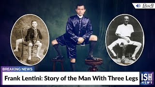 Frank Lentini Story of the Man With Three Legs  ISH News [upl. by Elwin112]