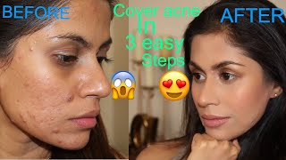 HOW TO COVER ACNE SCARS WITH BB CREAM IN 3easy steps [upl. by Tema]