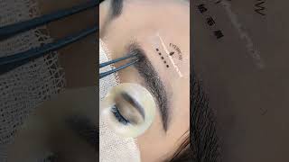 eyebrow transplantation eyebrow eyebrows sopracciglio sobrancrlhas cejas sourcils eyelashes [upl. by Lanuk]