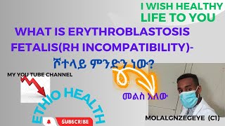 ሾተላይ ምንድን ነው [upl. by Phelips]