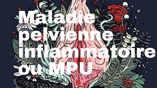 Maladie pelvienne inflammatoire ou MPU [upl. by Aiden]