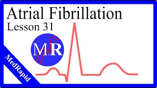 Atrial Fibrillation [upl. by Obel]