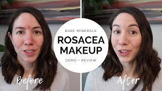 Bare Minerals for Rosacea  Demo  Review [upl. by Adyaj]