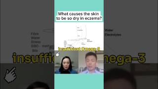 What causes the skin to be so dry with ECZEMA eczema dryskin dryskinrelief eczemarelief [upl. by Sirrep]