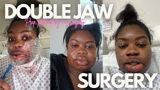 What its REALLY like having double jaw surgery  VLOG [upl. by Karyn]