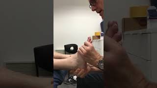 Ankle Fusion Patient 5 Months After Operation Showing Foots Range of Motion [upl. by Angid]