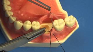 LEARN TO SUTURE THE EASY WAY  Surgical Technique  Interrupted Buccal Suturing  Dental  Medical [upl. by Almeda392]