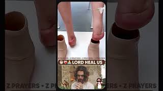 Lord Heal Us 👦❤️‍🩹 [upl. by Heger]