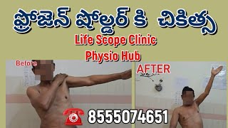 Relieve Frozen Shoulder Pain with Specialized Treatment at Life Scope Clinic physiohub Hyderabad [upl. by Nnyrat745]