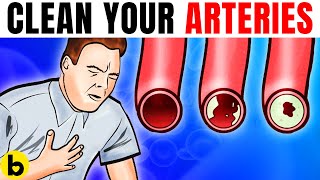 These Foods Unclog Arteries amp Can Prevent A Heart Attack [upl. by Nnazil]