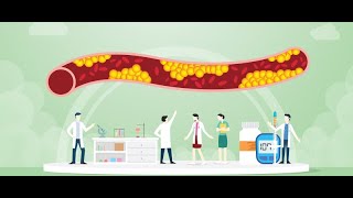 Course Outline for Studying Dyslipidemia [upl. by Hahsi102]