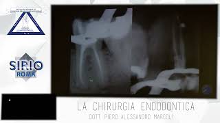 1Corso Di Endodonzia Chirurgica Parte 1 1 [upl. by Yhtomiht]