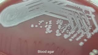 Citrobacter farmeri growth on CLED agar Blood agar and MacConkey medium [upl. by Nicodemus]