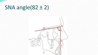 skeletal malocclusion classification orthodontics عربي [upl. by Krenn]