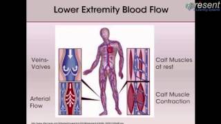 Venous Leg Ulcers Pathophysiology and Assessment [upl. by Harelda765]