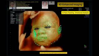 4D AI Integrated Emotional Facial Tracking Ultrasound [upl. by Petulia]