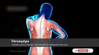 Fibromyalgia  Symptoms   Its Causes  Diagnosis  Treatment  Bio Anatomy [upl. by Sairtemed]