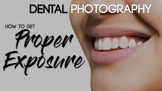 Dental Photography Basics  How to Take a Quality Dental Photo  Proper Exposure [upl. by Eirrod]