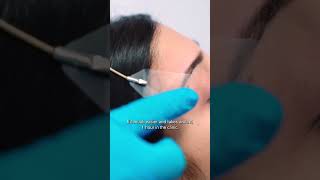 Get a Facelift Without Surgery All About Thread Lifts vanityface threadlift [upl. by Anitnatsnok671]