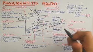 Pancreatitis causas fisiopatología clínica diagnóstico y tratamiento [upl. by Riffle]