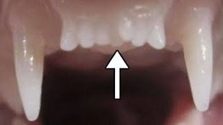 Worlds First Tooth Regrowing Drug Set To Start Human Trials [upl. by Grosmark]