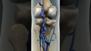 What causes varicose veins 3D Animation [upl. by Hindorff986]