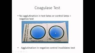 Identification of Staphylococcus [upl. by Gnidleif]