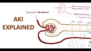 Acute Kidney Injury Explained [upl. by Naehs]