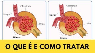 GLICOSE NA URINA  O QUE É E COMO CUIDAR PARA NÃO TER DIABETES [upl. by Magdalen]